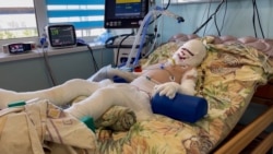 'Burns Cover 40 Percent Of His Body': Young Boy Survives Russian Attack That Killed His Mother 